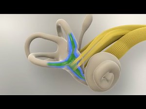 Enfermedad de Ménière: ¿qué sucede en el oído interno?