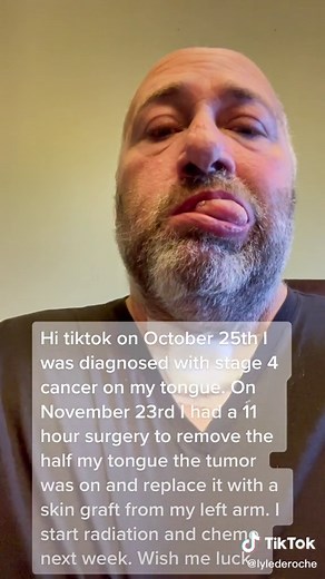 Stage 4 Tongue Cancer Update: Surgery and Treatment Journey