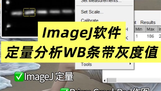 ImageJ软件｜定量分析WB条带灰度值‼️