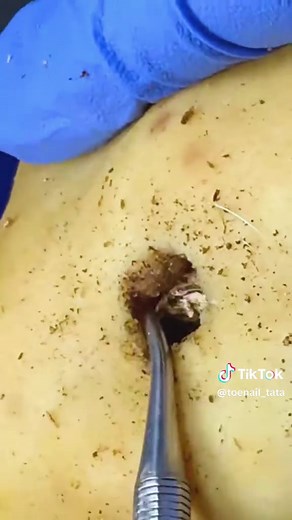 Toenail Tata on TikTok