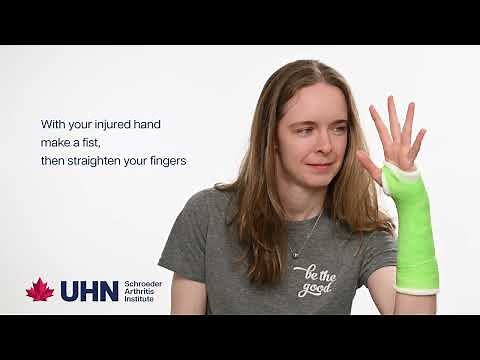 Exercises in a Cast for Patients with a Broken Wrist