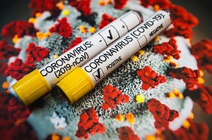 Test na koronawirusa. Badanie RT-PCR na COVID-19 prywatnie i na NFZ. Cena testu, adresy punktów drive-thru, jak wygląda badanie [15.11.2020]