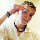 How to Get a Pimple to Go Away Fast