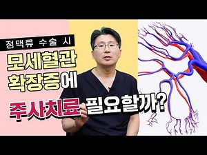 정맥류 수술 시 모세혈관확장증을 주사로 치료하는 경우와 아닌 경우는?