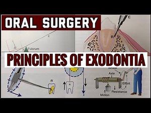 PRINCIPLES OF EXODONTIA II TOOTH EXTRACTION II ORAL SURGERY II imp
