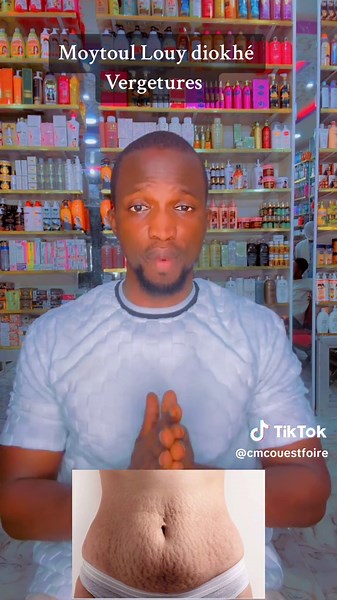 Louy Dindi Vergetures | Senegal TikTok