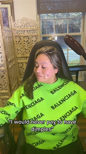 I can and I did ✨💉 DM Us “Dimples” to get started 🙏🏾 #dimpleplasty #plasticsurgery #atlanta #drcurves #dimples #foryou