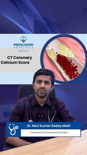 Medicover Hospitals Hitech City on Instagram: "A CT Coronary Calcium Score (CAC score) is a quick, non-invasive scan that helps detect calcium deposits in the coronary arteries, an early sign of coronary artery disease. Even before symptoms appear, this test can reveal your future heart attack risk and guide timely prevention. #medicoverhitechcity #CTCoronaryCalciumScore #CACScore #HeartHealth #CardiacScreening #PreventiveCardiology #CoronaryArteryDisease #EarlyDetection #HeartAttackPrevention #