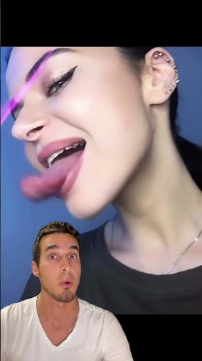 Why do they have such a big and long tongue? - Macroglossia