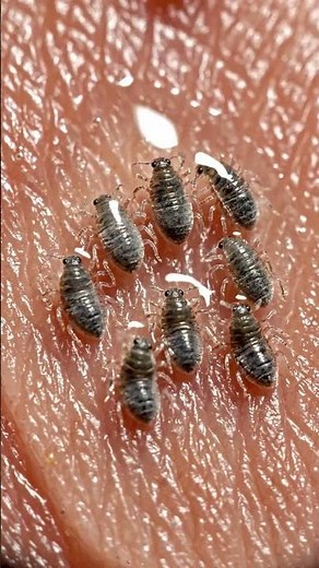 Mechanism of Action: Scabicides vs. Sarcoptes scabiei | Clinical Shorts.