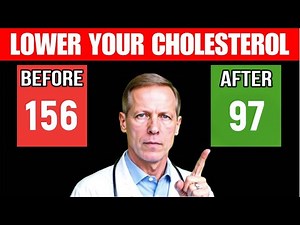 How To Lower Your Cholesterol Naturally (8 Simple Tricks That Works)