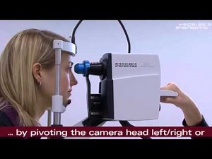 SPECTRALIS Anterior Segment Module - The perfect acquisition