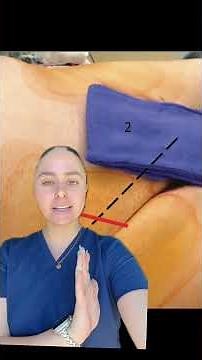 GROIN CHECKS happen commonly post-IR or post-cath lab procedures 🩸 nurses play an important role