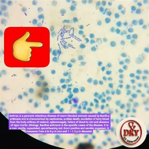 Bacillus anthracis || Non- motile || Capsulated || Spore bearing rod || Gram positive || Aerobic