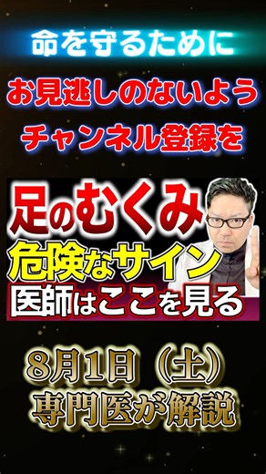 足のむくみの危険なサインを専門医が解説