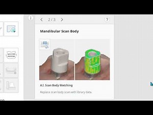 Implant Supported Denture Scan (ENG)
