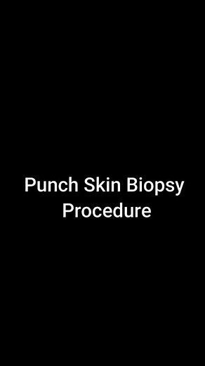 Punch biopsy/Skin biopsy 🔬 procedure #shorts | Akash Mangukiya