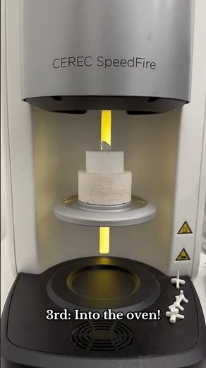 Watch a Same Day CEREC Crown Being Made 🦷 | Inside Dentique Dental North Sydney