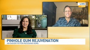 Pinhole Gum Rejuvenation: an easier fix for receding gums