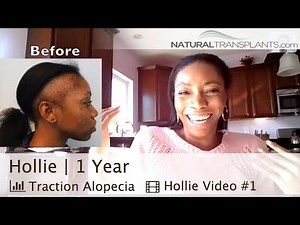 Hair Loss Treatment for Women Result | Traction Alopecia Hair Loss Treatment Result (Hollie)