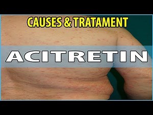 What is Acitretin, Causes, Symptoms and Treatments