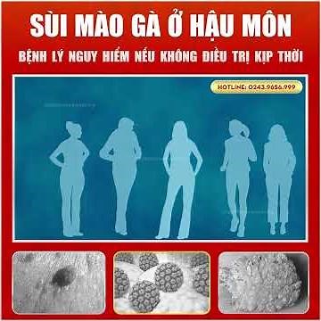 Sùi Mào Gà Ở Hậu Môn: Dấu Hiệu, Nguyên Nhân Và Cách Điều Trị