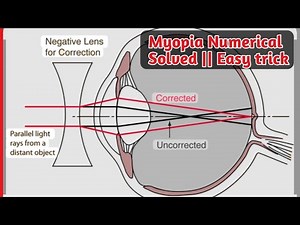 Myopia (Short-Sightedness) Explained with Numerical | Class 10 Science Human Eye