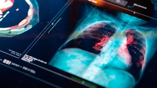 Le radon : un tueur invisible dans votre maison