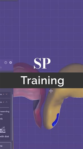 Seth Potter | Certified Exocad Trainer | Training Session episode 108 This clip is from a weekly group coaching call I had on my online academy I coach teams and owners on time... | Instagram