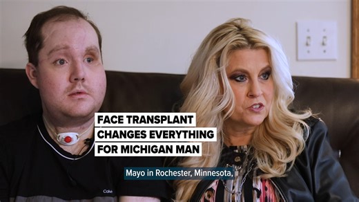 🔗: https://l.mlive.com/hotzx6 In March 2014, Derek Pfaff was home for spring break from Saginaw Valley State University when he attempted to take his own life with a shotgun. He survived, but what followed was a decade of struggle and survival. He went through 58 surgeries in attempts to repair the damage to his face. Finally a face transplant at the Mayo Clinic this year changed everything. (Kaytie Boomer/MLive.com) | MLive.com