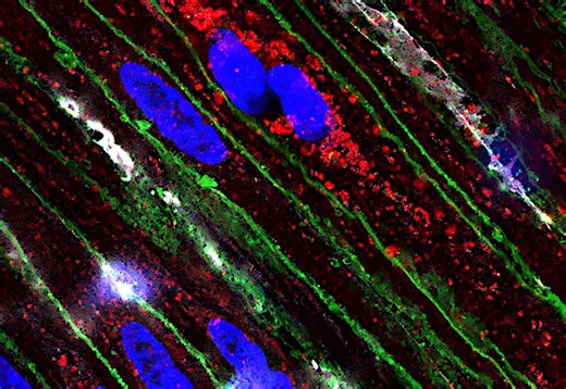 Piezo1 protein discovered as critical regulator of gut health