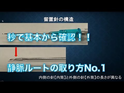 点滴ルート確保I 基本編 こそべん7 静脈 コツ サーフロー 留置針