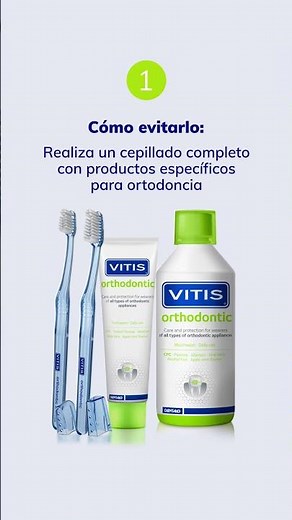 Vitis Orthodontic