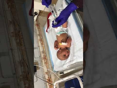 IV Treatment for Neonatal Jaundice: What Parents Need to Know"phototherapy care eye paid