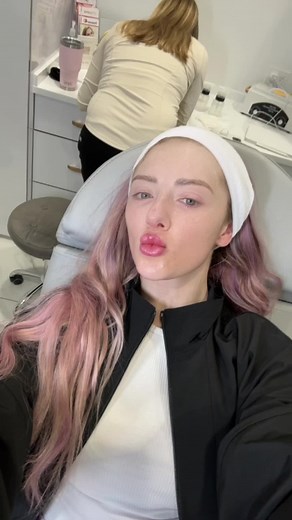 Morpheus8 treatments can last up to 12 months - 3 years depending on factors like age, skin condition, environment, lifestyle, diet, etc. This was my first treatment so I will continue to post updates through out my experience! I pre purchased 3 treatments - they say to do lasers like this in series of 3 and sometimes more depending on your skin. I believe microneedling is way more painful, but I’ll let you decide which is worse! Microneedling / Morpheus8 are similar, yet different. Microneedlin