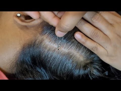 Scalp Check ASMR - Hair & Sleep Tingle Therapy