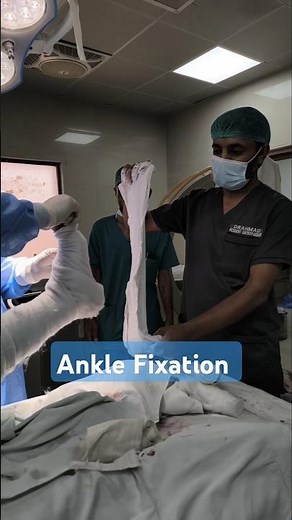 Open Reduction Internal Fixation Ankle Done By Dr Younis Ahmad - Orthopedic Surgeon