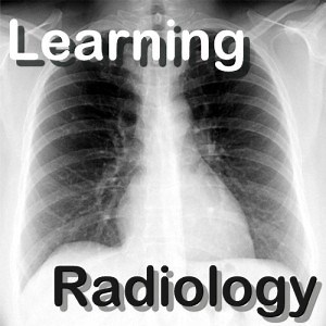 LearningRadiology Video Podcasts | Free Listening on Podbean App