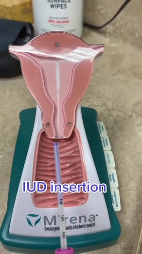 Gyno_girls on TikTok