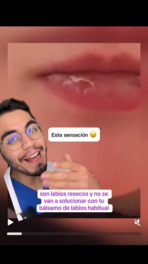 Dermatólogos Online | Labios resecos #queilitis #sequedad #labio | Instagram
