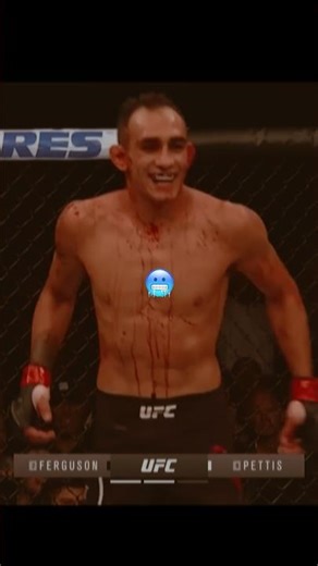 The Bloodiest Fight Ever in UFC History 😱🥶
