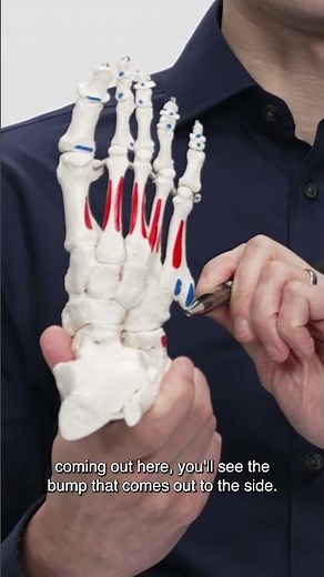 Could This Be The Cause Of Your Foot Pain?