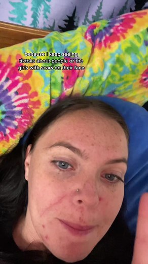 Lunacat Scarface: The Cat with a Mysterious Marking