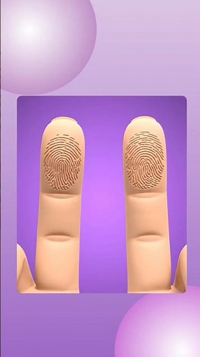 Why Identical Twins Have Different Fingerprints 🔍