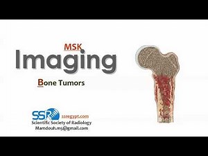 Bone Tumors ..Prof.mamdouh Mahfouz (2019 edition)