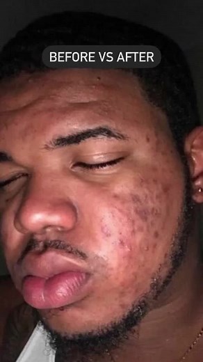 Transform Your Daily Routine with Lumin Men's Skincare