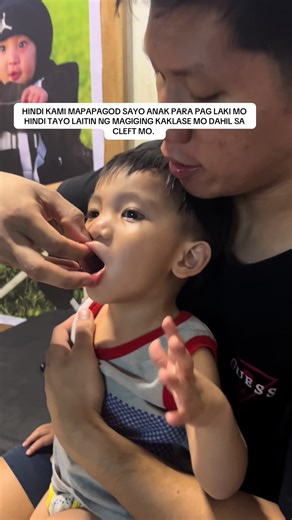 Epektibong Pagsusuri sa Keloid para sa Cleft Lip