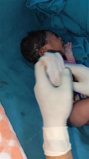 18K views · 387 reactions | ✨ Newborn Baby First Outfit | Cute Dressing Moment After Birth #afterbirth #fblifestyle #NewbornBaby #FirstDress #CuteBabyMoments #BabyCare #ParentingLove #BabyFashion #AdorableBaby #BundleOfJoy #PreciousMoment #NewbornStyle | Little Angel Care | Facebook