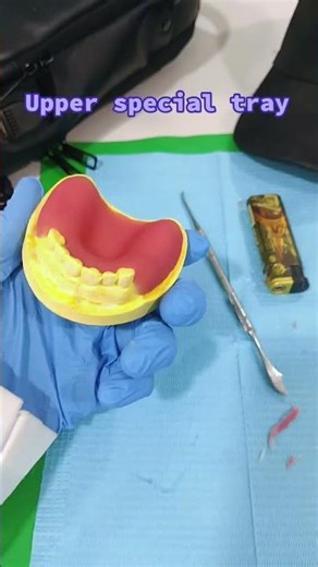 Upper special tray prosthetic 🦾