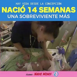 287K views · 1.9K reactions | Nadie Menos Tru Beare nació 14 semanas...